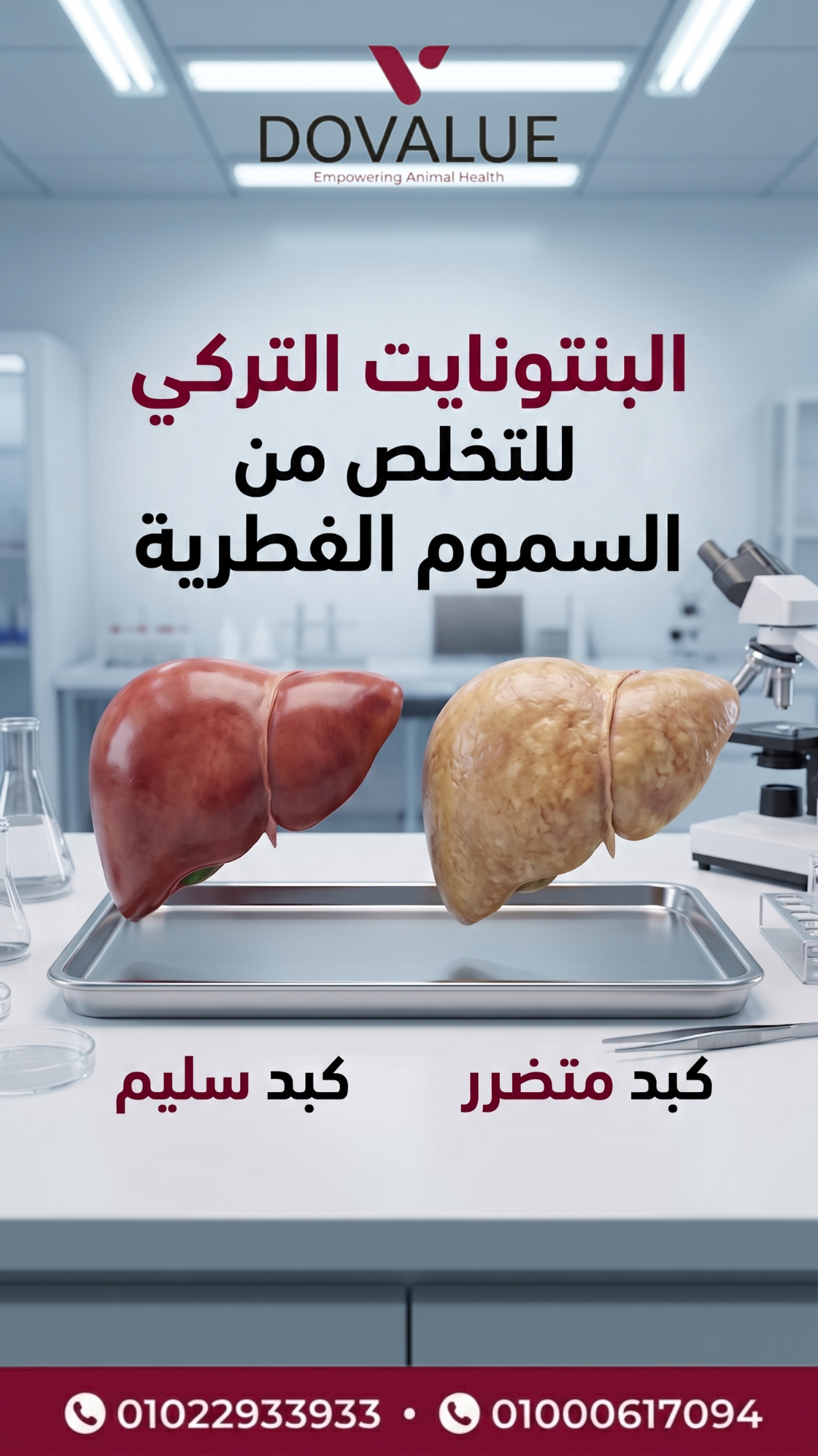 الستوري 2